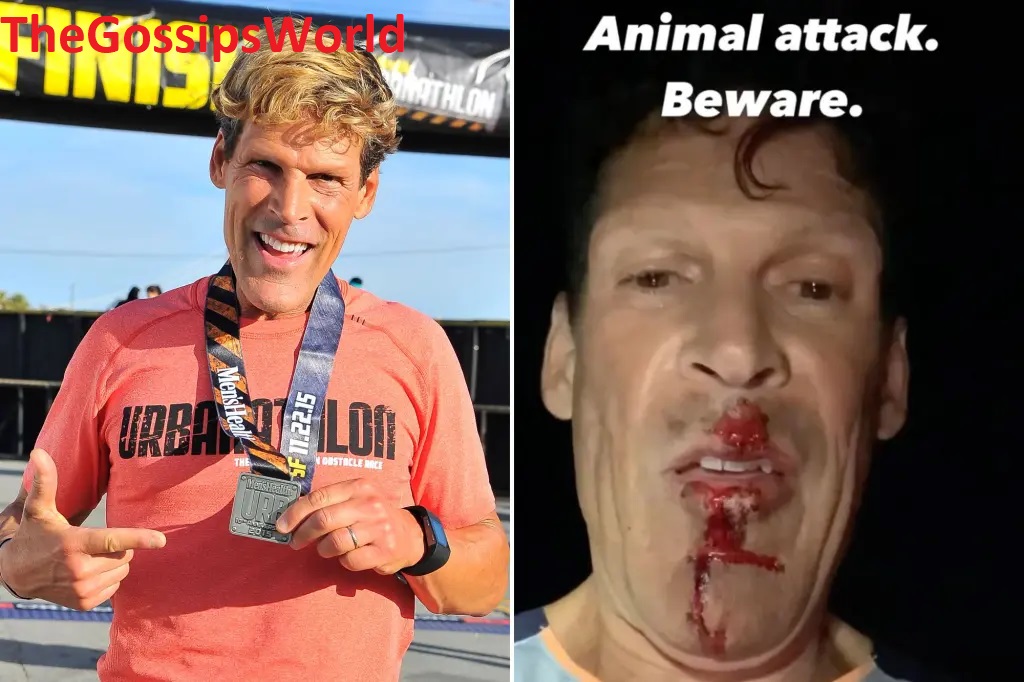 Ultramarathon Runner Attacked by Coyote During Race Video