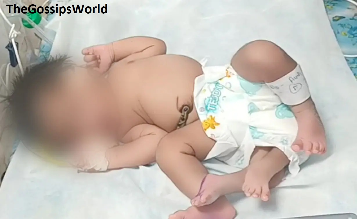 A Baby Girl Born With Four Legs In Gwalior Pictures
