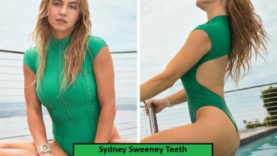 Sydney Sweeney Teeth